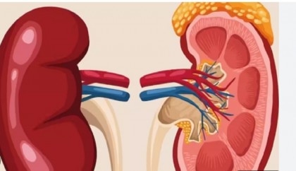 How to keep your kidneys healthy
