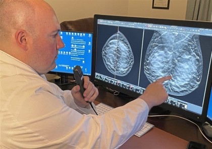 Mammograms should start at 40, says US task force