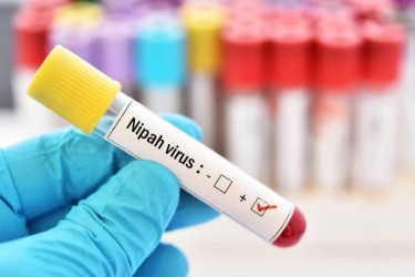 One dies of Nipah virus in Manikganj