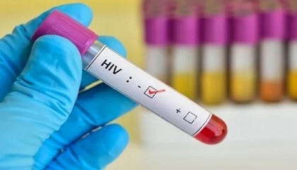 Third person cured of HIV after stem cell transplant: study