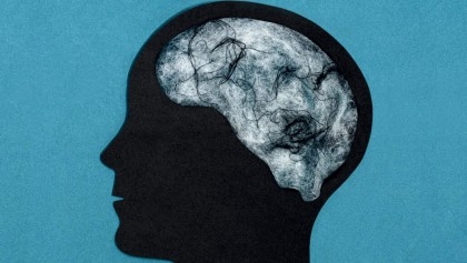 Scientists Find That 'Brain Fog' Of Long Covid Equivalent To Ageing 10 Years

