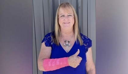 Texas woman injured after hawk drops snake on her