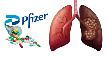 Strong trial results for Pfizer lung cancer drug