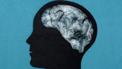 Scientists Find That 'Brain Fog' Of Long Covid Equivalent To Ageing 10 Years

