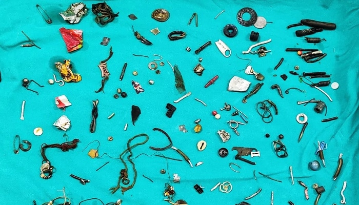 Rakhis, earphones, screws among 100 items pulled from Punjab man's stomach